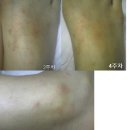 에버노블 이미지