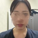 채롱 | 피부과, 30대피부관리, 나는솔로순자리프팅, 부산리프팅맛집, 부산올타이트리프팅 내돈내산 2회차후기!!