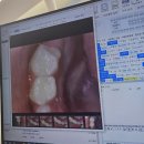 율치과의원 | 과잉진료 없는 시흥 샛별 소아치과 구강검진 후기