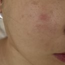 샬롬사커스쿨 - 구미시 인동38길 15-6 | 어여쁘다에서 받은 피부맞춤 PT! 모공부터 탄력까지 갓벽 후기