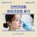 326 | 인천코성형후기 하이코프팅 후기 슬한의원 전후사진!