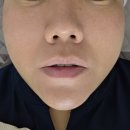 영(Young)피부관리실 | 청주에스테틱 뷰티:YOUNG 페이스 윤곽관리 후기_청주피부관리실 브이라인 관리 추천