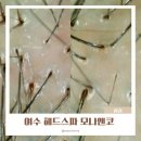 로터스(주) | 여수 헤드스파 모나앤코 출산 후 두피케어 및 탈모관리