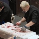 SMILE뽑기샵 | 부산 서면 쌍수 성형외과 : 처진눈 탈출! 절개 쌍꺼풀수술 후기