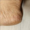 메디레스큐 이미지