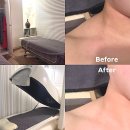 아주네트웍스(주)목동서비스 | 목동 에스테틱 윤곽관리 미인본가 후기 | 작은 얼굴 관리, 승모근 변화까지