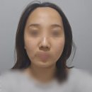 [내돈내산] 올라웨이브 얼굴, 이중턱 리프팅 후기