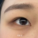 베스트안경 위드렌즈 이미지