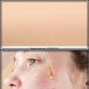 연세티트리의원 | 꿀피부 비법 대방출! 블랙헤드, 촉촉 오일, 백탁 고민 끝!