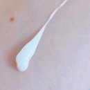 이연의원 | 시술관리템 루아센시아(Luassnecia) CPR크림 솔직 후기