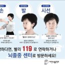 &#39;침묵의 살인자&#39; 뇌졸중 의심 증상 &#39;이웃·손·발·시선&#39; 4가지를 기억하세요 이미지