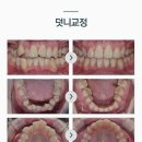 서울사랑니치과의원 이미지