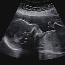 [임신 일상] 은혜산부인과 다녀왔어요~! 홀가분한 임당검사 통과 후기