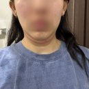 (주)이모드디자인 | [내돈내산] 홈모드 써마 리프트 언박싱 &amp; 디바이스 강도 테스트 후기