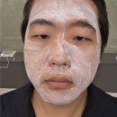 대전 이동규의원 오픈런 후기｜새신랑 피부관리 셀라스 레이저 최신근황