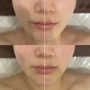 피부;피어나리