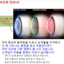 목천안경 이미지