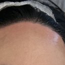 희헤어라인 이미지