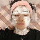 강남대중한의원 | 강남 편평사마귀 성지 자연재생한의원, 편평사마귀 쥐젖 잡티 점빼기 + 비용, 애프터관리 10일 후기