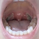 CU 오천신세계점 | [일상]청주 우리베이커리 부평점부터 조승연 콘서트를 지나 편도 수술까지…(feat.로지텍 K380S 키보드)