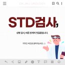 에스티디(STD)
