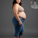 엣지라인의원 | 💰뱃살 지방흡입 가격 및 시술 후기, 부작용과 주의사항