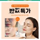 타임피부과 네이버블로그