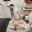 연세베러의원 | 도대체 써마지 효과가 뭐길래? 피부과 실장이 직접 받은 찐 후기