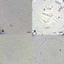 흰다리새우의 검은 아가미병 원인 Fusarium verticillioides 이미지