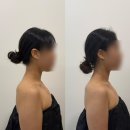 남구청소년수련관 주차장 | 광주 웨딩관리 봉선동 웨딩관리 추천 연아스킨랩 팔뚝관리 슬리밍관리 후기
