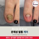 레푸스 경기광주점 네이버블로그