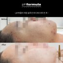 접촉성 피부염과 피부가려움증, 바디부터 페이스까지! 달서구 피부관리 후기