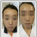 YM메디칼 이미지