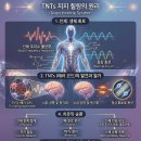 TNTs 지지 힐링 이미지