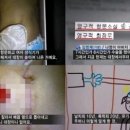 [펌] 조두순사건 영문번역판 -해외방송사로... 이미지