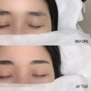 서연인테리어 - 동구 구성로 240 | 발산역 자연눈썹 추천 마곡 눈썹문신 잘하는 곳 서연브로우 후기