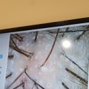 탈모케어존부산 이미지