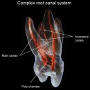 혁신굿모닝치과의원 | 부평구치과, 신경치료 재발 방지하는 비밀 2단계