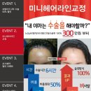 헤어짱헤어라인