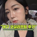 나이스마트대신점 | 대구피부과 추천 | 대구코필러 대신 리쥬엘코 후기 솔직하게 공개해요
