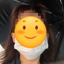 [주근깨 레이저] 압구정 루비레이저 / 딱지 착색 등 회복과정 후기(2)