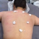인삼약초로 | [초량] 신부관리 필수코스 등관리 약초필링 1회 후기 - 초량 리안뷰티