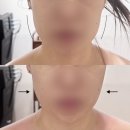 아늑 | [관악/신림]아늑 에스테틱 방문 후기