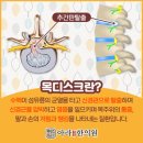 아라한의원 네이버블로그