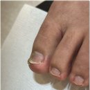 닥터아이티엔 네일의아침 대전서구점