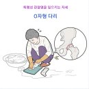 👣 O자형, X자형 다리는 왜 생길까 ? 이미지