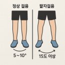 발리짐 노원역점 | [노원역 헬스장] 팔자걸음이신가요?