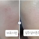 모리스화장품 - 구로구 구로중앙로7길 28 | GD11 리페어 플러스 앰플 사용후기