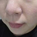 더바른피부과의원 이미지