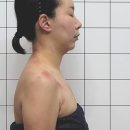 전주림프관리 리바디앤뷰티 체형 리모델링 후기 순환이 잘 되니 혈색까지 좋아졌어요
